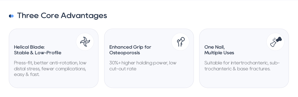 PFNA интрамедуларен пирон | Фиксиране на фрактура на проксимална бедрена кост