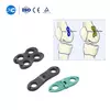 Pediatric Valgus Varus Orthopedic System | Limb Deformity Correction Implant- 2