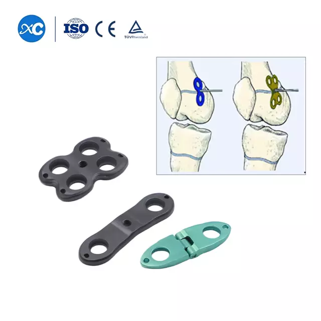 Pediatric Valgus Varus Orthopedic System | Fanitsiana fanitsiana ny rantsambatana- 2