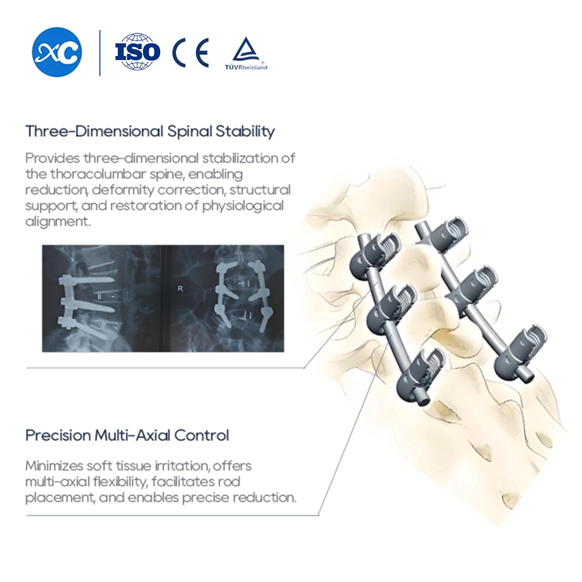 6.0mm Spinal Pedicle Screw System | Thoracolumbar Fusion | XC Medico