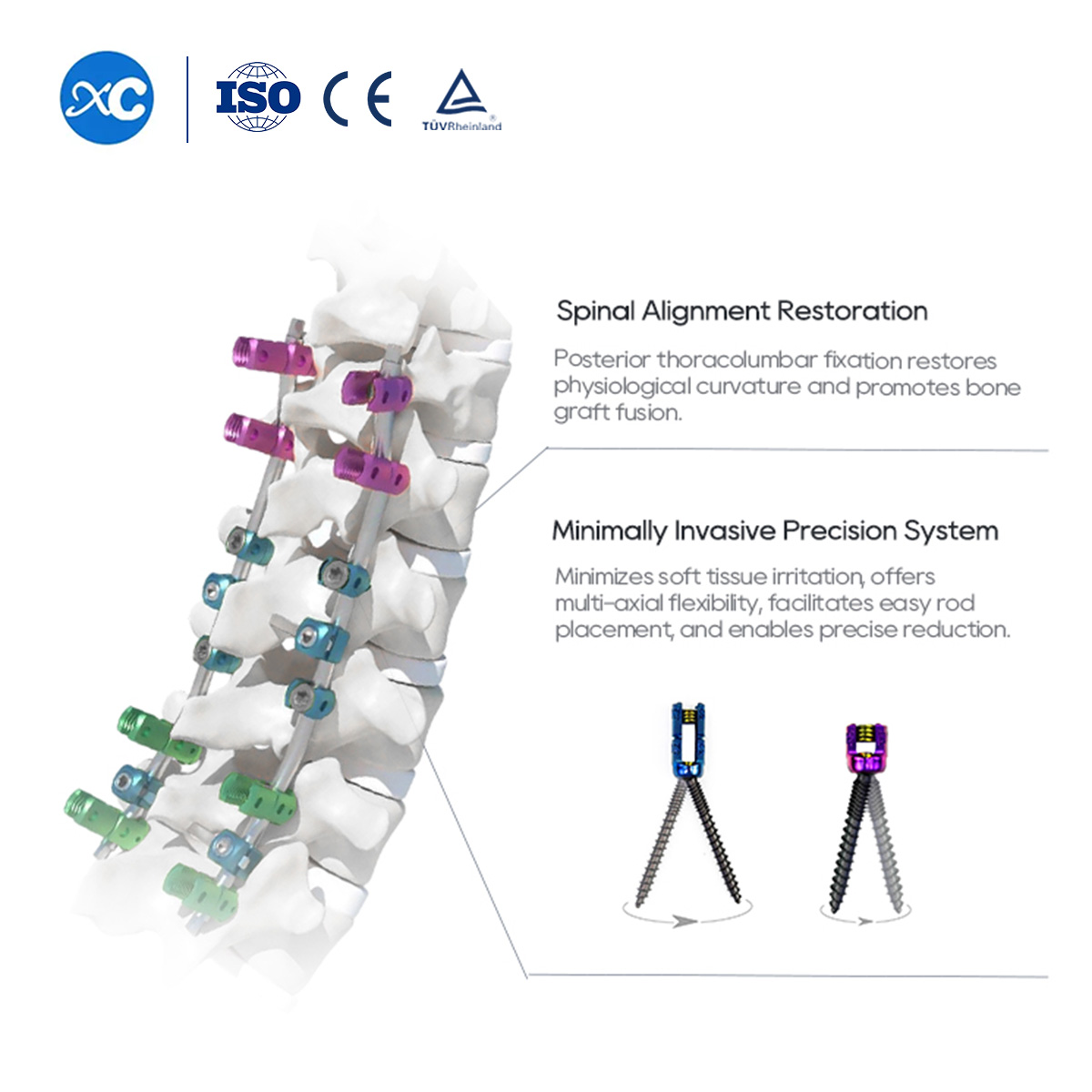 Spinal Pedicle Screw System (5.5mm) | Titanium Orthopedic Implants & Surgery Instruments