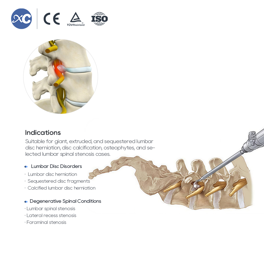 Transforaminal Endoscopic 10.0 Instrument Set | XC Medico