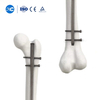 Femoral Intramedullary Nail | Femur Fixation | XC Medico