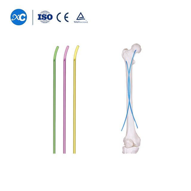 Titanium Elastic Nail System for Pediatric Fracture Fixation | XC Medico