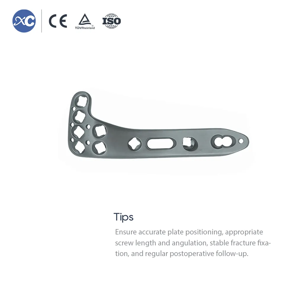 Multi-axial Lateral Tibial Plateau Locking Plate