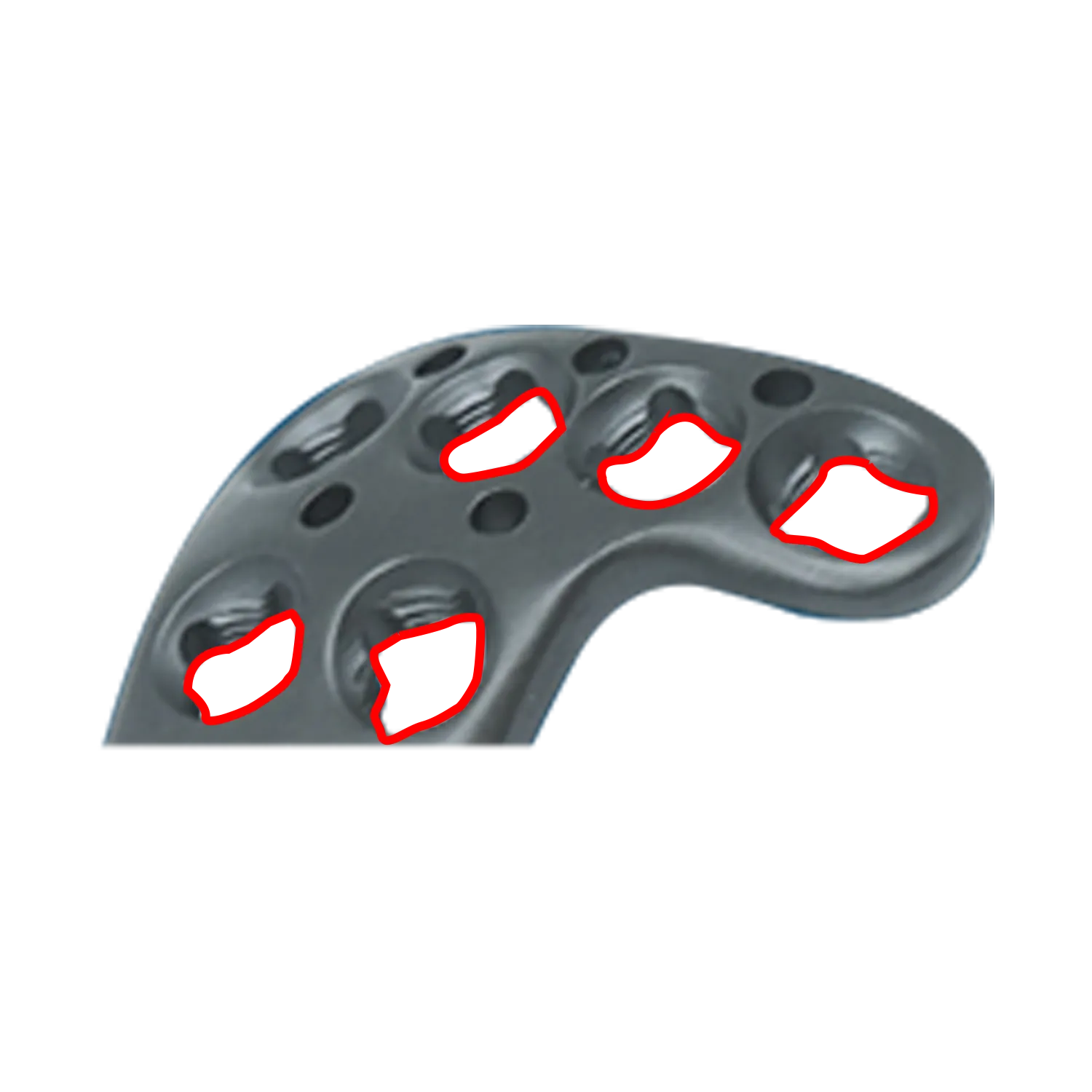 Polyaxial locking holes allowing &plusmn;15&deg; screw angulation in tibial plateau plate head