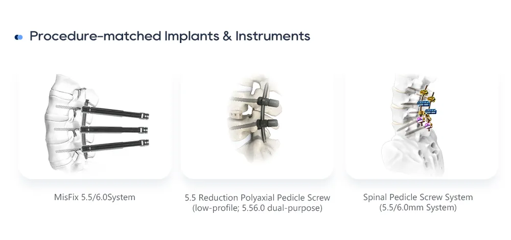 Procedure-Matched Lumbar Spine Implants and Instrument Systems