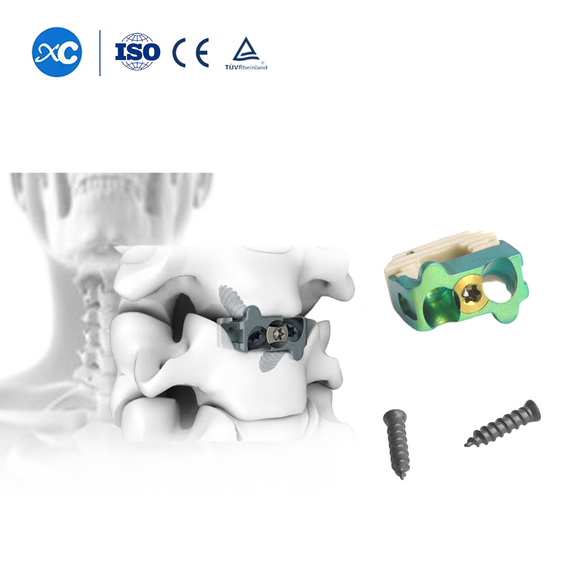 0 Profile Cervical Cage- XC Medico