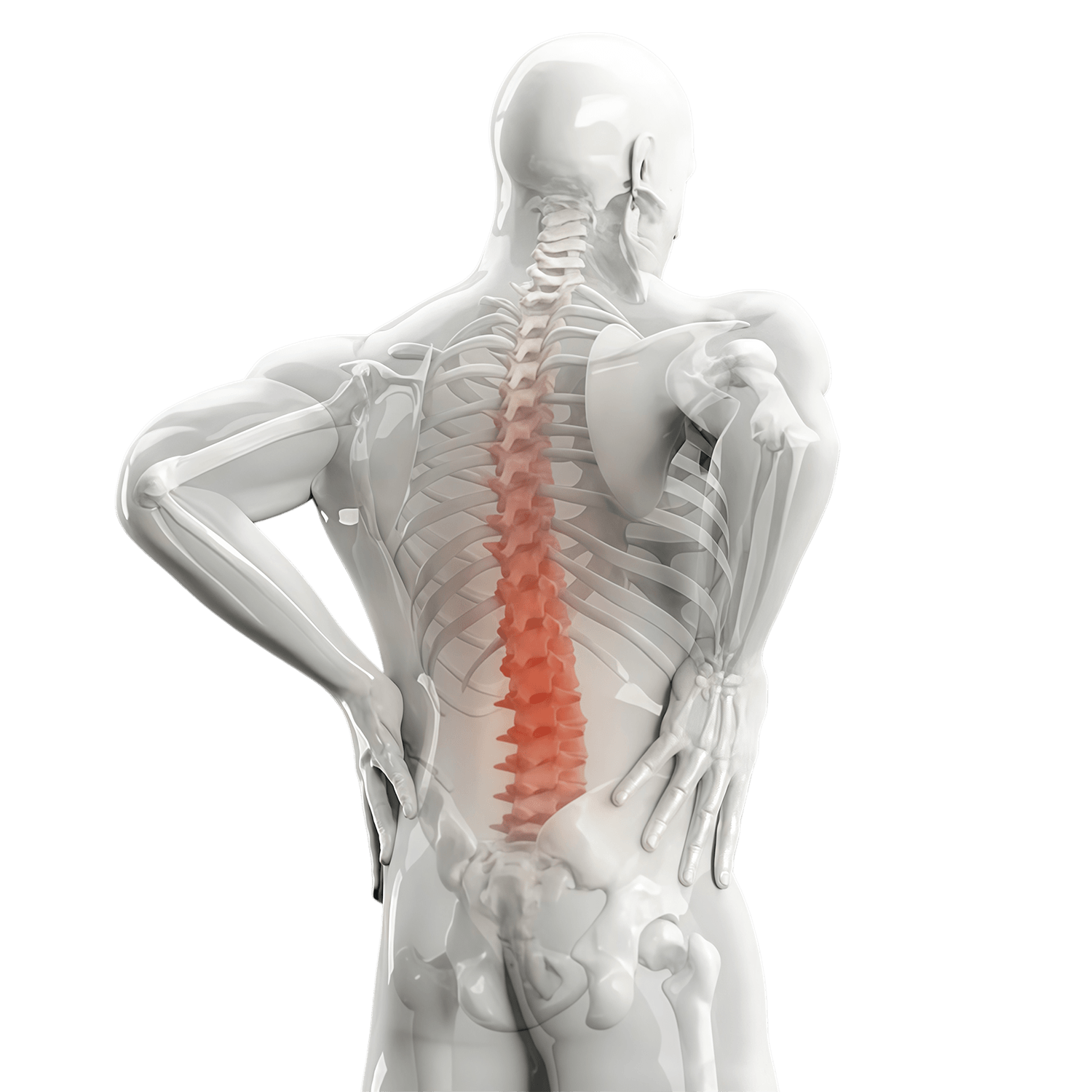 PLIF posterior lumbar interbody fusion papiso ea anatomical