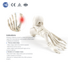 MIS Hallux Valgus Instrument Set | Factory Direct | XC Medico