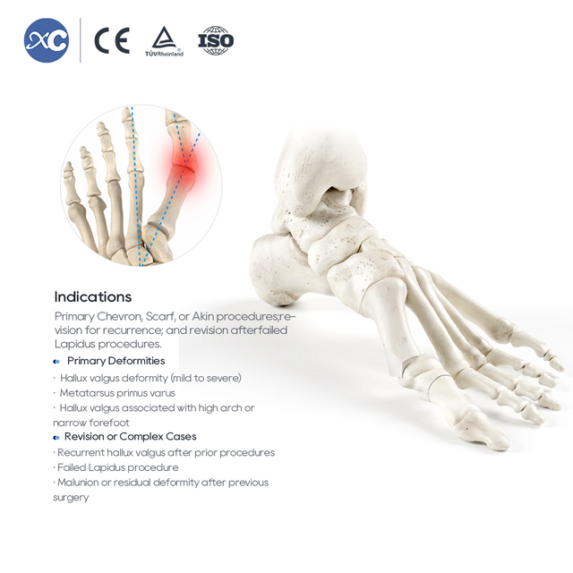 MIS Hallux Valgus Instrument Set | Factory Direct | XC Medico