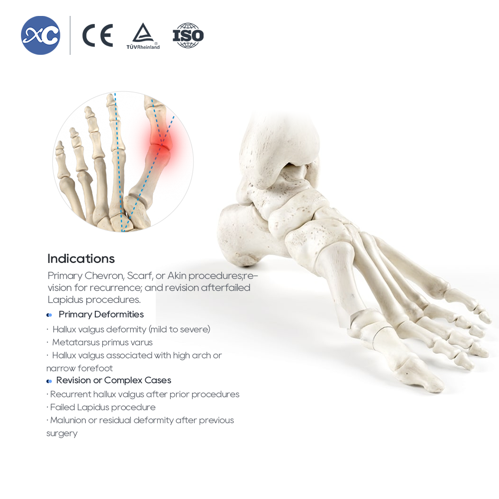 MIS Hallux Valgus Instrument Set | Factory Direct | XC Medico