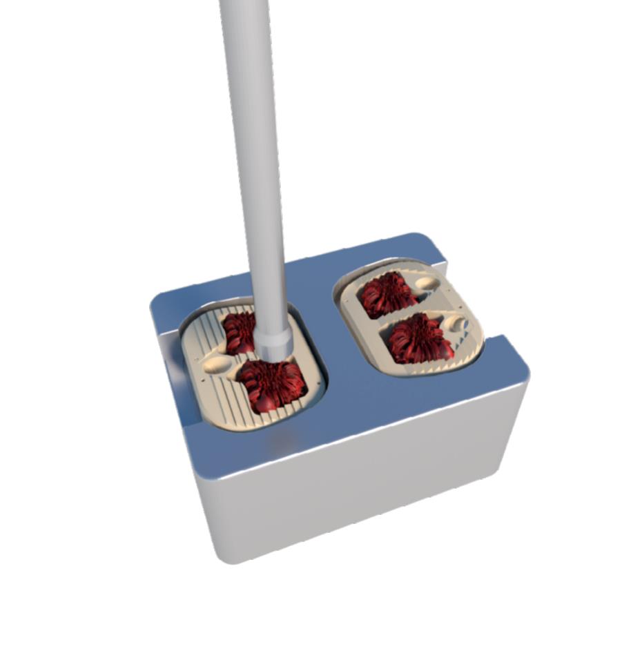 Packing bone graft into the ALIF cage