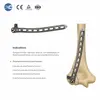 Distal humerus lateral locking plate fixed on humerus bone model