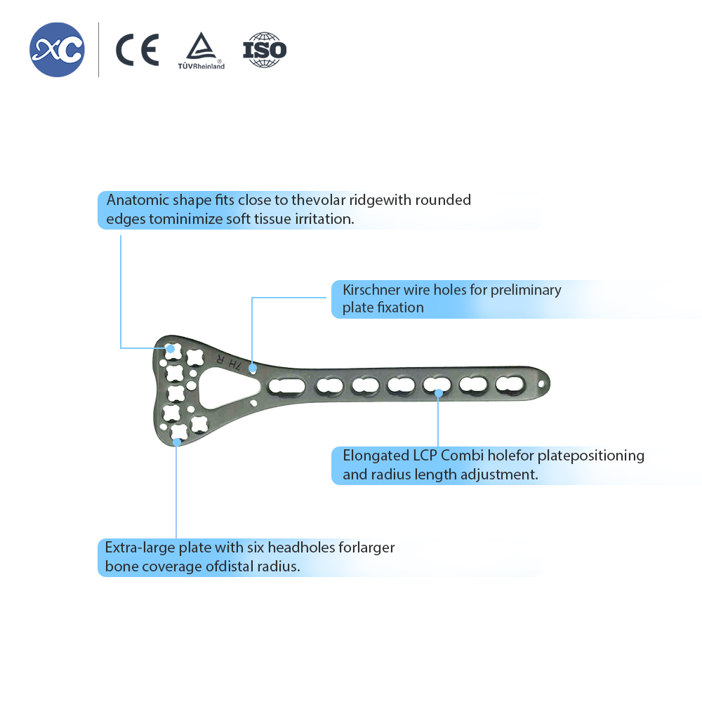 Distal Radius Locking Plate (7 Holes) - XC Medico - 4