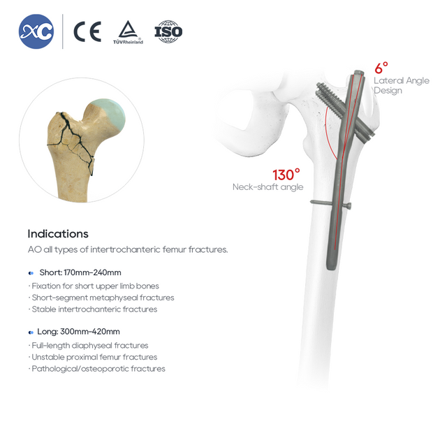 Intertan Nail System | xc medico