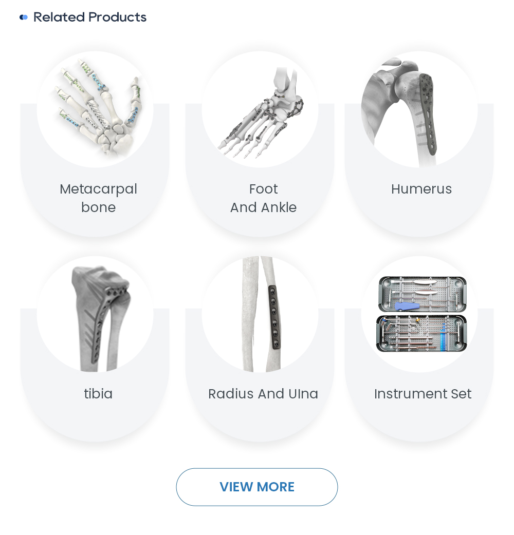 Related Orthopedic Trauma Implants: Metacarpal Bone, Foot and Ankle, Humerus, and Radius Fixation