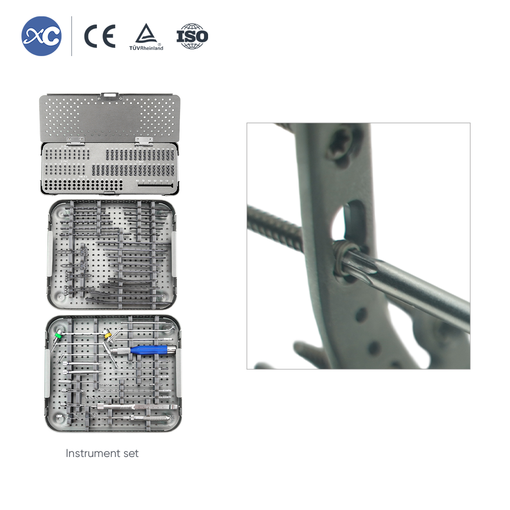 Distal Radius Volar Multi-axial Locking Plate | Titanium Orthopedic Implants & Fracture Fixation
