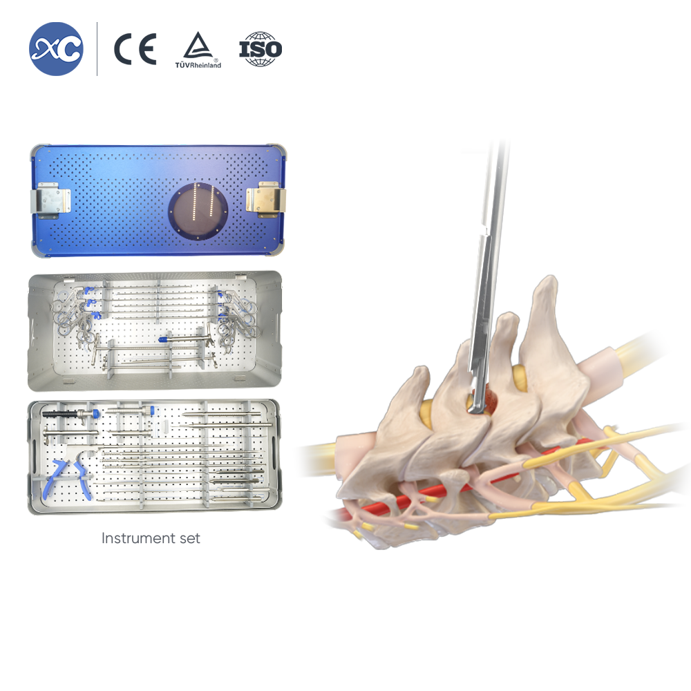 Transforaminal Endoscopic 10.0 Instrument Set | XC Medico